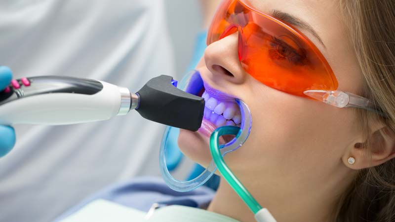 Teen having laser teeth whitening after braces