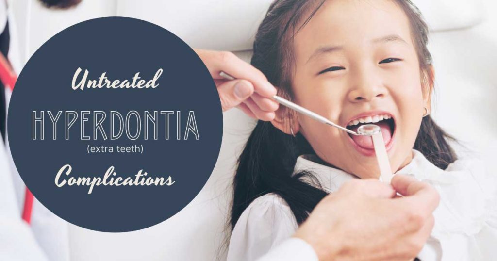Untreated Hyperdontia Complications Untreated Hyperdontia Extra Teeth Complications Girl at Dentist