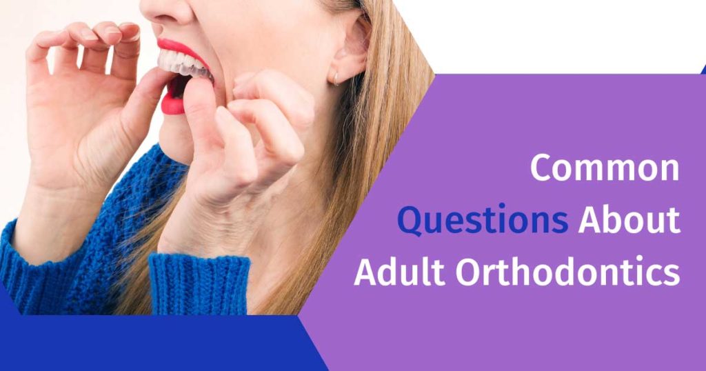 Questions About Adult Orthodontics Invisalign Tray