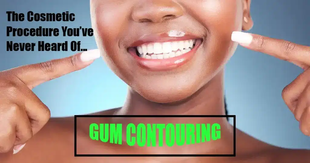 Cosmetic Dentistry Procedure Gum Contouring