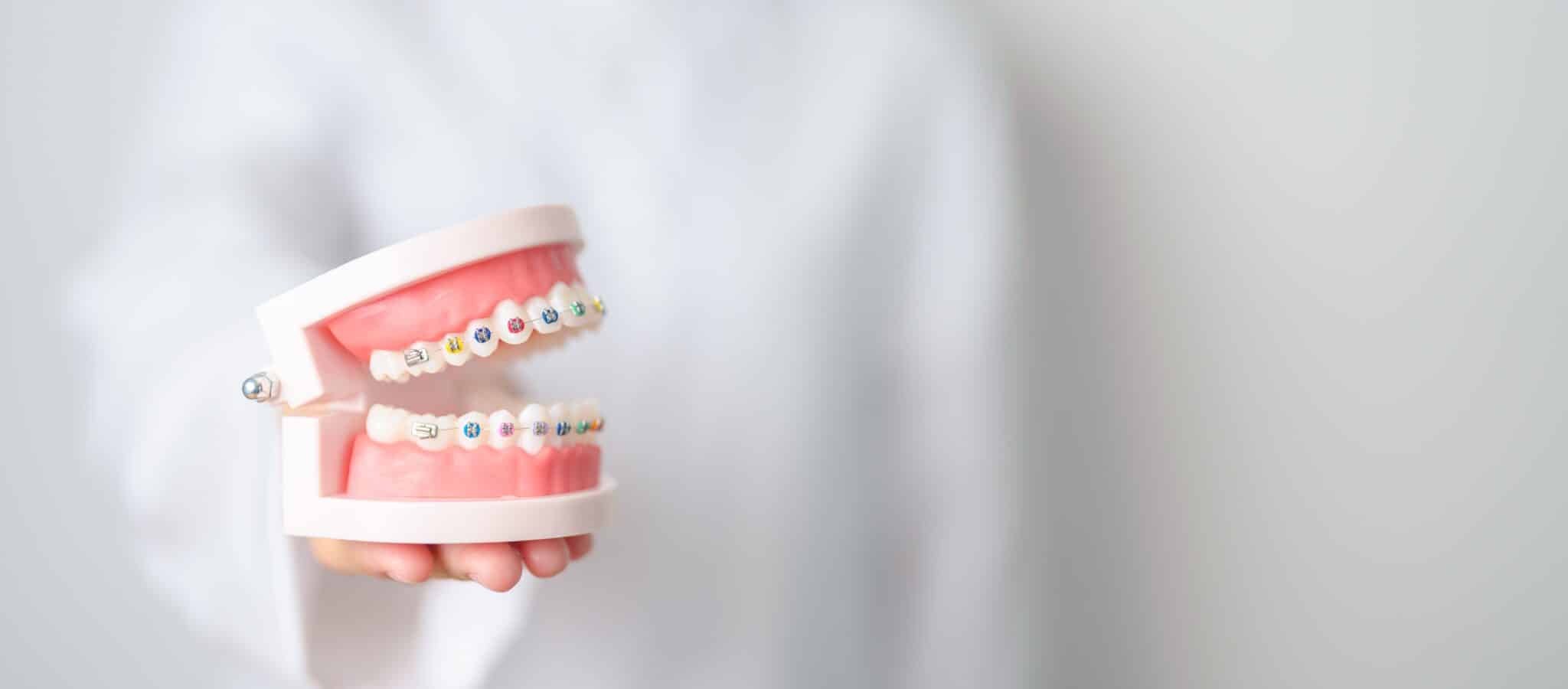 Early Orthodontic Intervention St. Charles